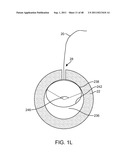 METHOD FOR VESSEL ACCESS CLOSURE diagram and image