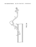 METHOD FOR VESSEL ACCESS CLOSURE diagram and image