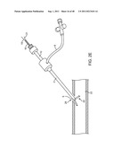 METHOD FOR VESSEL ACCESS CLOSURE diagram and image