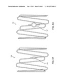 METHOD FOR VESSEL ACCESS CLOSURE diagram and image