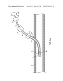 METHOD FOR VESSEL ACCESS CLOSURE diagram and image