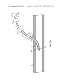 METHOD FOR VESSEL ACCESS CLOSURE diagram and image