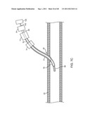 METHOD FOR VESSEL ACCESS CLOSURE diagram and image