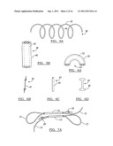 Adjustable Knotless Loops diagram and image