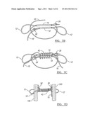 Adjustable Knotless Loops diagram and image