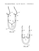 Adjustable Knotless Loops diagram and image