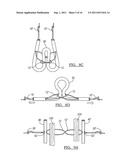 Adjustable Knotless Loops diagram and image