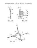 Adjustable Knotless Loops diagram and image