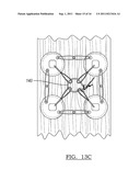 Adjustable Knotless Loops diagram and image