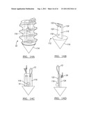 Adjustable Knotless Loops diagram and image