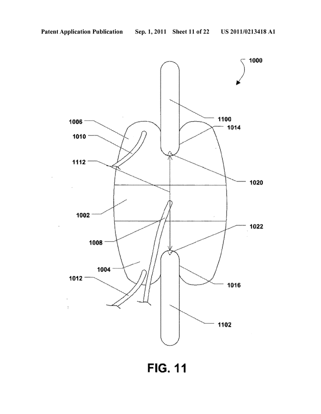 MULTI-CHAMBER EXPANDABLE INTERSPINOUS PROCESS SPACER - diagram, schematic, and image 12