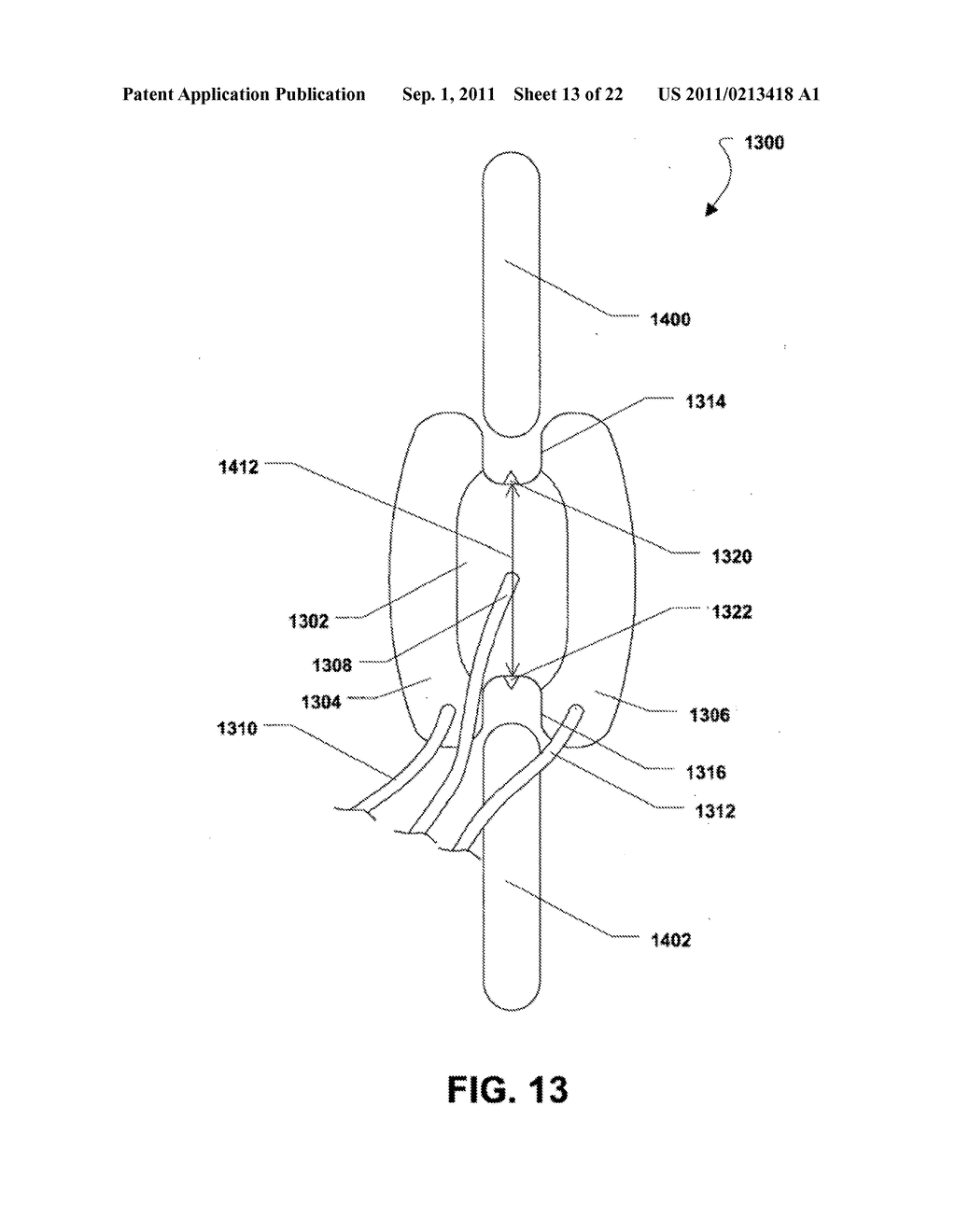 MULTI-CHAMBER EXPANDABLE INTERSPINOUS PROCESS SPACER - diagram, schematic, and image 14