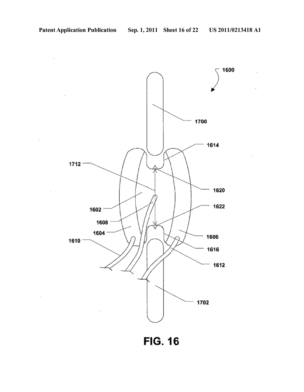 MULTI-CHAMBER EXPANDABLE INTERSPINOUS PROCESS SPACER - diagram, schematic, and image 17