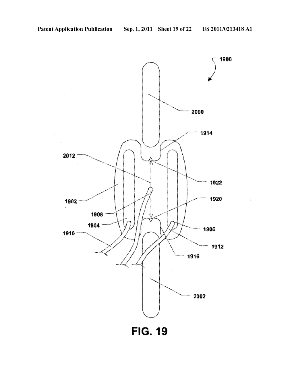 MULTI-CHAMBER EXPANDABLE INTERSPINOUS PROCESS SPACER - diagram, schematic, and image 20