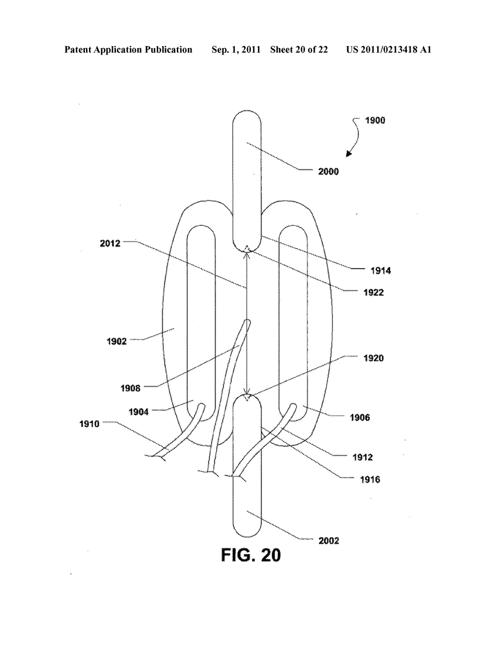 MULTI-CHAMBER EXPANDABLE INTERSPINOUS PROCESS SPACER - diagram, schematic, and image 21