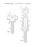 Spinal Implant diagram and image