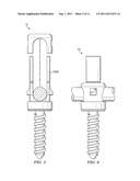 Spinal Implant diagram and image