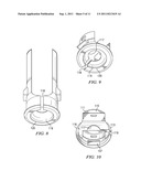 Spinal Implant diagram and image