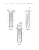 Spinal Implant diagram and image