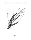 ORTHOPEDIC FIXATION ASSEMBLY AND METHOD OF USE diagram and image