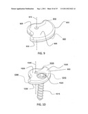 ORTHOPEDIC FIXATION ASSEMBLY AND METHOD OF USE diagram and image