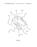 ORTHOPEDIC FIXATION ASSEMBLY AND METHOD OF USE diagram and image