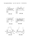 Patient Selectable Joint Arthroplasty Devices and Surgical Tools diagram and image