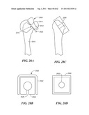 Patient Selectable Joint Arthroplasty Devices and Surgical Tools diagram and image