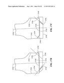 Patient Selectable Joint Arthroplasty Devices and Surgical Tools diagram and image