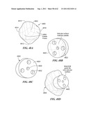 Patient Selectable Joint Arthroplasty Devices and Surgical Tools diagram and image