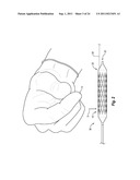 MEDICAL DEVICE SHIELD AND METHODS FOR DELIVERING A MEDICAL DEVICE diagram and image