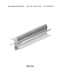 STENT diagram and image