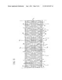 ANGIOPLASTY STENTS diagram and image