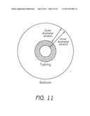 METHODS FOR MANUFACTURING MULTI-LAYER BALLOONS FOR MEDICAL APPLICATIONS diagram and image