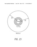 METHODS FOR MANUFACTURING MULTI-LAYER BALLOONS FOR MEDICAL APPLICATIONS diagram and image