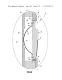 EXPANDABLE MILL AND METHODS OF USE diagram and image