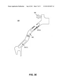 METHODS AND SYSTEMS FOR ROUTING CONDUCTORS IN ELECTRO-MECHANICAL MACHINES diagram and image