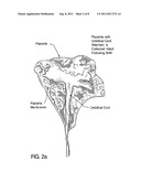 TREATMENT OF RADIATION INJURY USING PLACENTAL STEM CELLS diagram and image