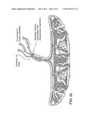 TREATMENT OF RADIATION INJURY USING PLACENTAL STEM CELLS diagram and image