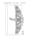 TREATMENT OF RADIATION INJURY USING PLACENTAL STEM CELLS diagram and image