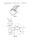 MAGNETIC NANOMATERIALS AND METHODS FOR CHEMOEMBOLISATION diagram and image