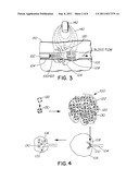 MAGNETIC NANOMATERIALS AND METHODS FOR CHEMOEMBOLISATION diagram and image