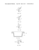 METHOD OF MOLDING MULTI-LAYER POLYMERIC ARTICLES HAVING CONTROL OVER THE     BREAKTHROUGH OF THE CORE LAYER diagram and image