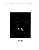 TREATMENT AND PROPHYLAXIS OF AMYLOIDOSIS diagram and image