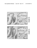 EPITOPES DERIVED FROM SATB2 AND USES THEREOF diagram and image