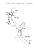 ANCHORS FOR USE IN MEDICAL APPLICATIONS diagram and image