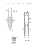 ANCHORS FOR USE IN MEDICAL APPLICATIONS diagram and image