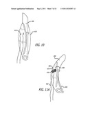 ANCHORS FOR USE IN MEDICAL APPLICATIONS diagram and image