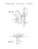 ANCHORS FOR USE IN MEDICAL APPLICATIONS diagram and image