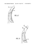 ANCHORS FOR USE IN MEDICAL APPLICATIONS diagram and image